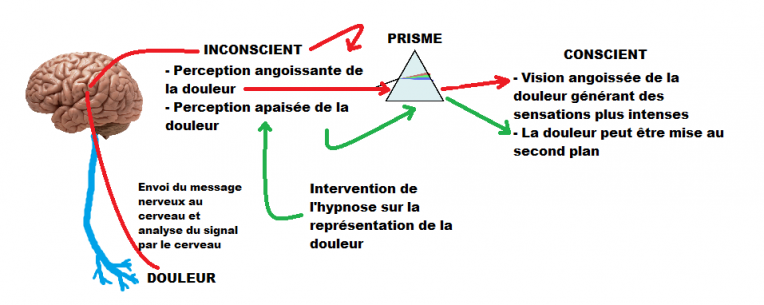 douleur-shema.png